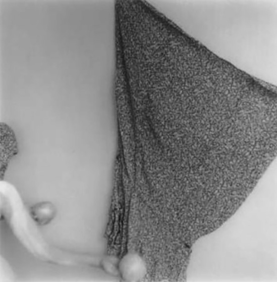 Francesca Woodman-Two Grapefruit , MacDowell Colony, Peterborough, New Hampshire,, 1979-80(Courtesy George and Betty Woodman )