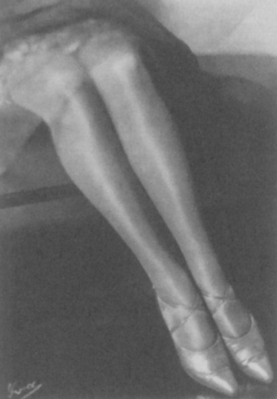 Yva (Else Neuländer)-Beine Legs, 1929