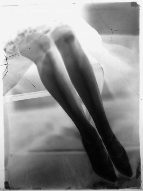 Yva (Else Neuländer)-Beine,1927-28 [  Original glass negative]